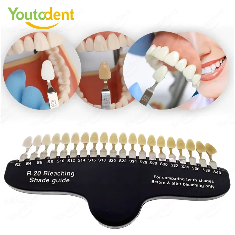 Teeth Whitening Before And After - Guia de Cores para Clareamento Dental