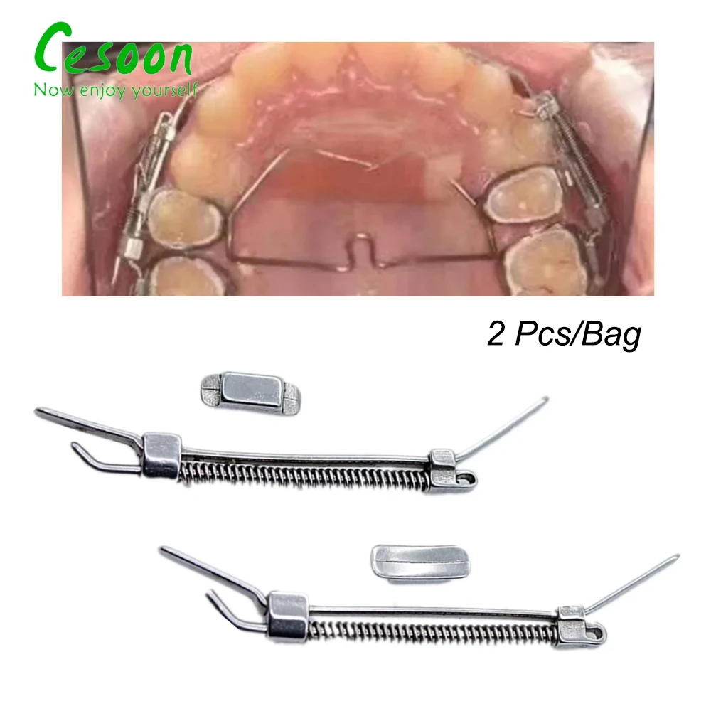 2 шт./упаковка Стоматологічний ортодонтичний молярний штовхач Задня розширювальна пружина Арковий дріт з нержавіючої сталі Стоматологічні