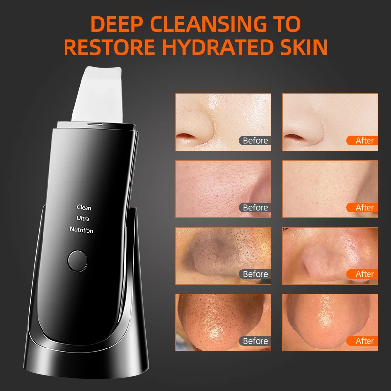 Skin Care 1 Ultrasonic Face Skin Scrubber Facial Lift Scraper Blackhead Remover Facial Cleanser Deep Cleansing Cleansing Spatula