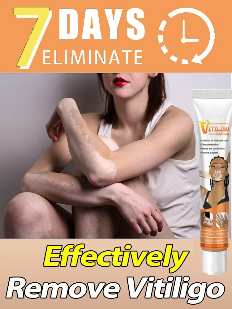 

Vitiligo Removal Effectively Remove White Spot Removal Skin Vitiligo Eliminate Vitiligo Body Skin Care