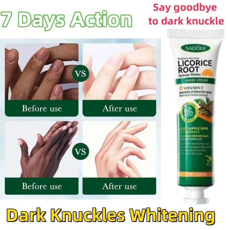 Fast Whitening Dark Knuckles Brighten Hand Cream Melanin Corrector Moisturizing Intense Stains Remover Cosmetics Skin Care 2024