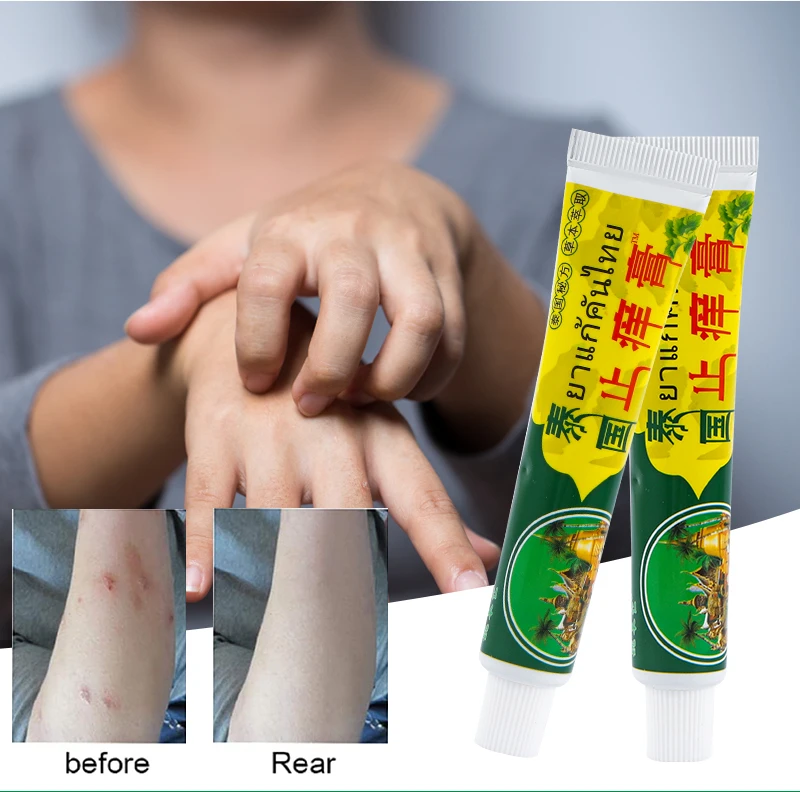 20g Only $0.99 Thailand Psoriasis Cream Menthol Cooling Balm Inhibits Skin Fungu Anti-itch Ointment Treat Rash Eczema Dermatitis