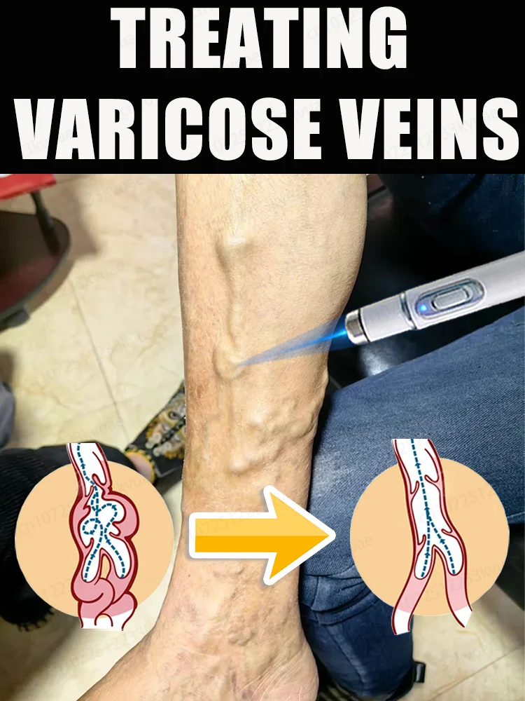 

ⱽᵉⁱⁿ ᵇˡᵘᵉ ˡⁱᵍʰᵗ ᵗᵒᵒˡ ᶜᵒᵐᵇⁱⁿᵃᵗⁱᵒⁿ ᔆᵉᵗ ᴾᵃᶜᵏᵃᵍᵉ ᵀᵒᵒˡˢ ᶜᵃⁿ ᵇᵉ ᵖᵘʳᶜʰᵃˢᵉᵈ ⁱⁿᵈⁱᵛⁱᵈᵘᵃˡˡʸ ᵒʳ ⁱⁿ ᶜᵒᵐᵇⁱⁿᵃᵗⁱᵒⁿ ᔆᵃʸˢ ᴳᵒᵒᵈᵇʸᵉ ᵀᵒ ᔆᵖⁱᵈᵉʳ ᴸᵉᵍˢ