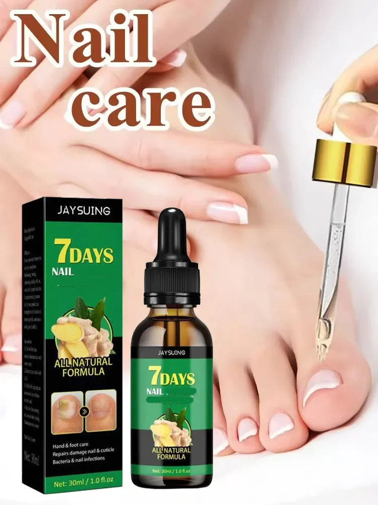 Nail 𝐅𝐮𝐧𝐠𝐮𝐬 𝐓𝐫𝐞𝐚𝐭𝐦𝐞𝐧𝐭 𝐎𝐧𝐲𝐜𝐡𝐨𝐦𝐲𝐜𝐨𝐬𝐢𝐬 𝐑𝐞𝐩𝐚𝐢𝐫 Herbaceous Essential oil For 𝐏𝐚𝐫𝐨𝐧𝐲𝐜𝐡𝐢𝐚