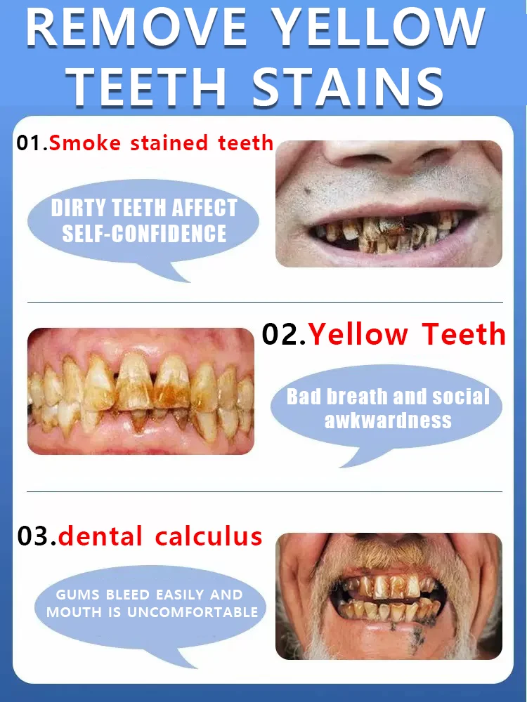 Wasserdichte intraorale reparatiepatch uit 2025, tandcorrectiepatch, beschadigd en verkleurd intraorale verzorgingstool