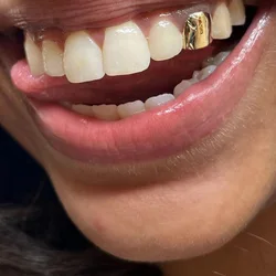 RACHELZ Classic Single Glossy Teeth Grillz Hip Hop 14K Gold Plated Tooth Caps Decor For Women Men Jewelry Party Gift
