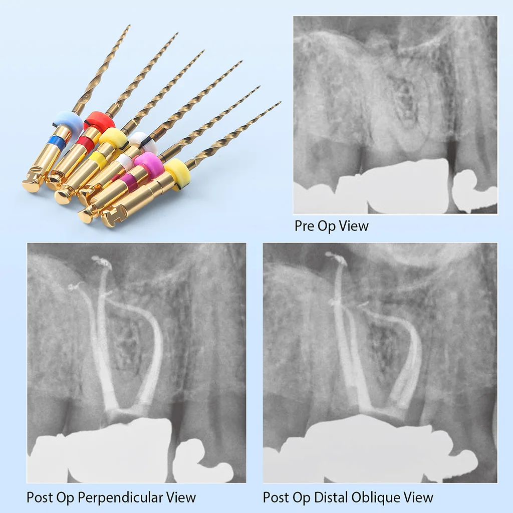 Dental Gold Flexible Feilen Endo Endodontische Wurzelkanal-Rotationsfeilen 21/25/31mm für Motoranwendung NiTi Zahnmedizinische Instrumente AZDENT – Detail 4