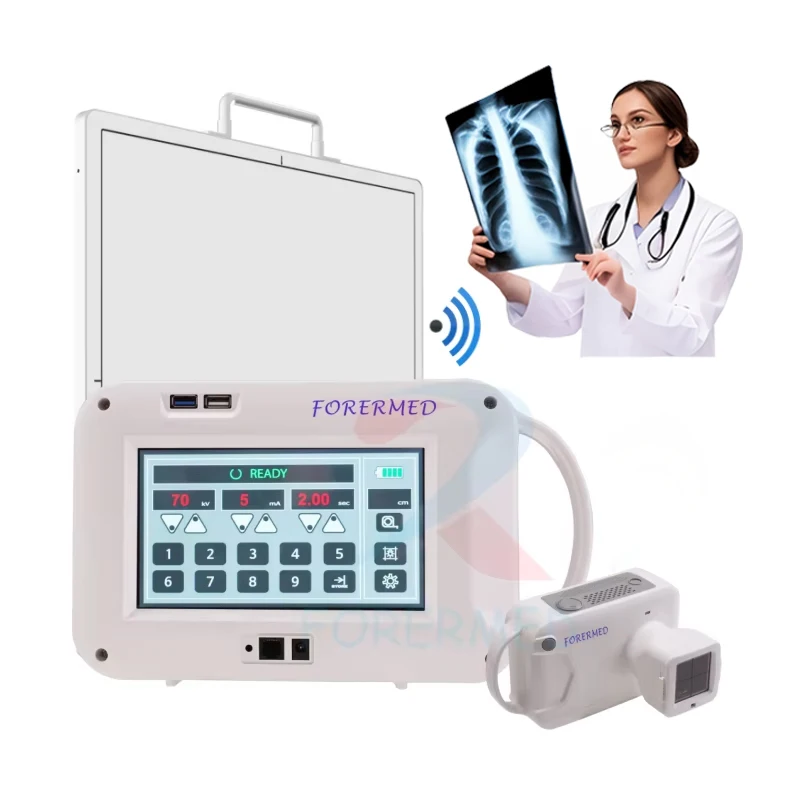 DR Portable X Ray Machine For Veterinary Human Radiology Equipment Digital Flat Panel Detector Stationary X-ray Imaging System