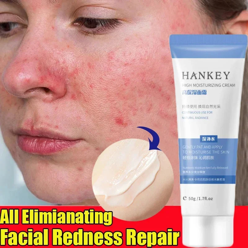 Facial Redness Repair Cream Improve Sensitive Skin Dryness Moisturizer Hydrating Sooth Lotion Removal Rosacea Korean Cosmetics