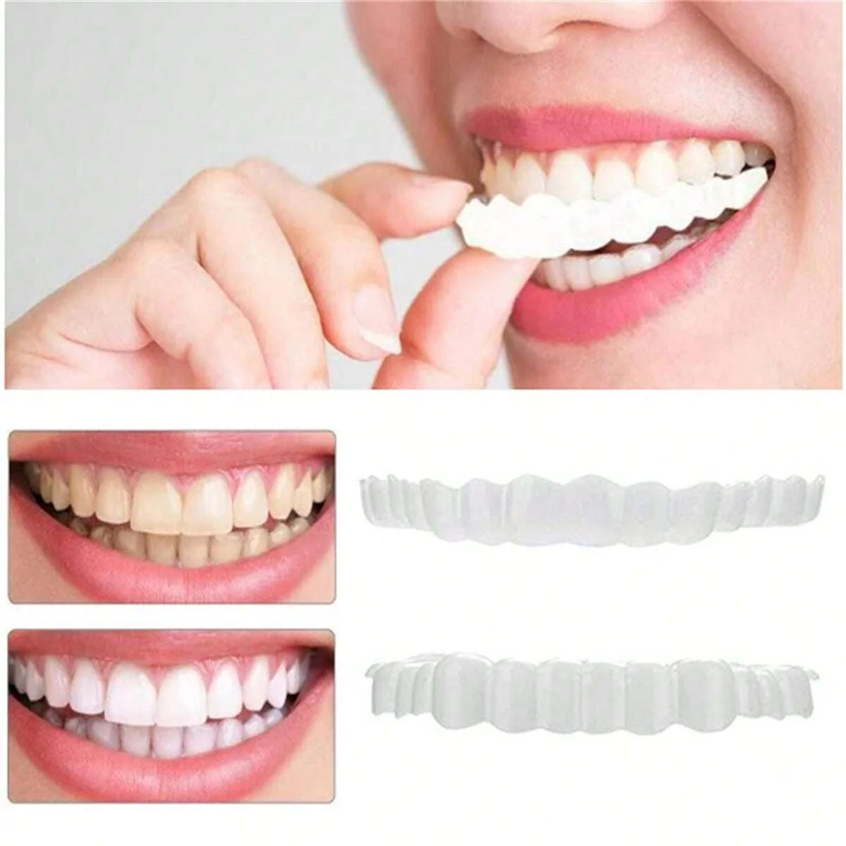 2 sets of Temporary dentures braces eating tools homemade and aesthetically pleasing dental patches dentures and braces