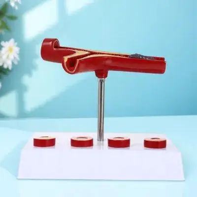 

Учебное пособие по анатомии человека: атеросклероз сердечно-сосудистой системы, прочный ПВХ, реалистичная модель для изучения физиологии в школах, кровеносная система