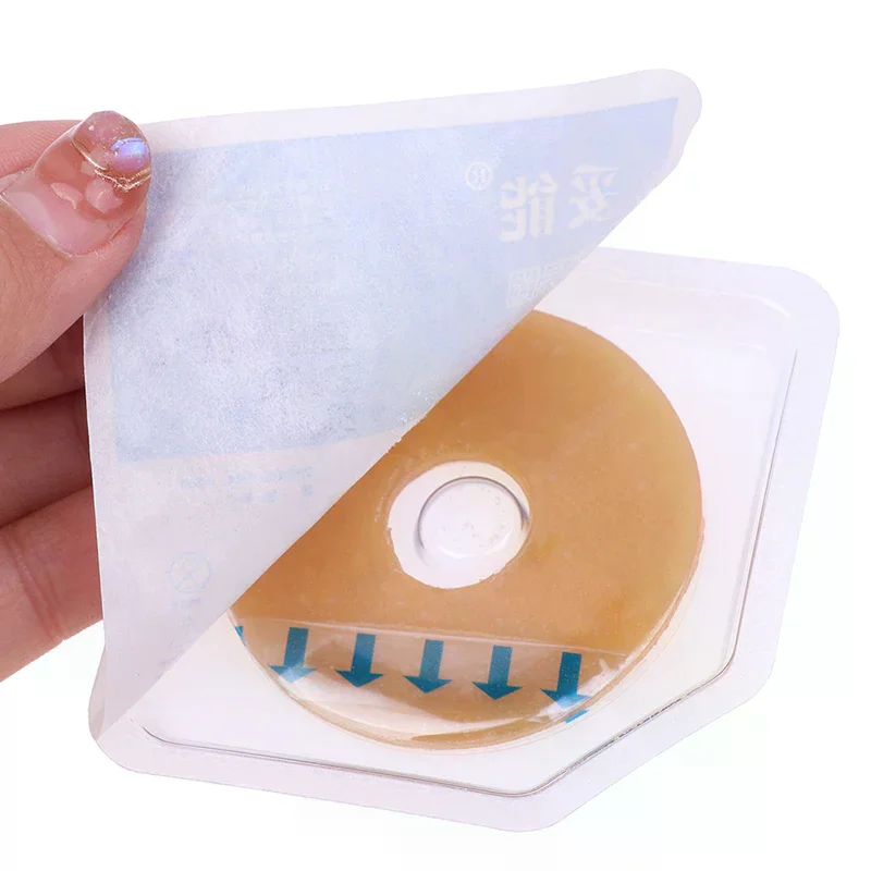 Ostomy Paste Ring Baseplates Stoma Care Leak-Proof Ring For Ostomy Bag Stretch Shaping To Prevent Leakage Protect Skin Care Tool