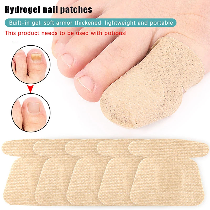 

10Pcs Toenail Fungus Patch Nail Repair Patches Nail Ingrown Correction Stickers For Discolored Or Damaged Nails Care