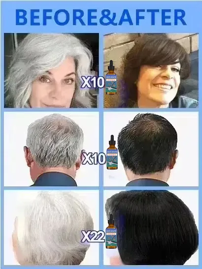 블랙헤어리퀴드는 노년층의 흰머리를 제거하고 자연스럽게 흰머리를 예방하며 자연스러운 모발 색상과 검은머리를 효과적으로 회복시켜줍니다.