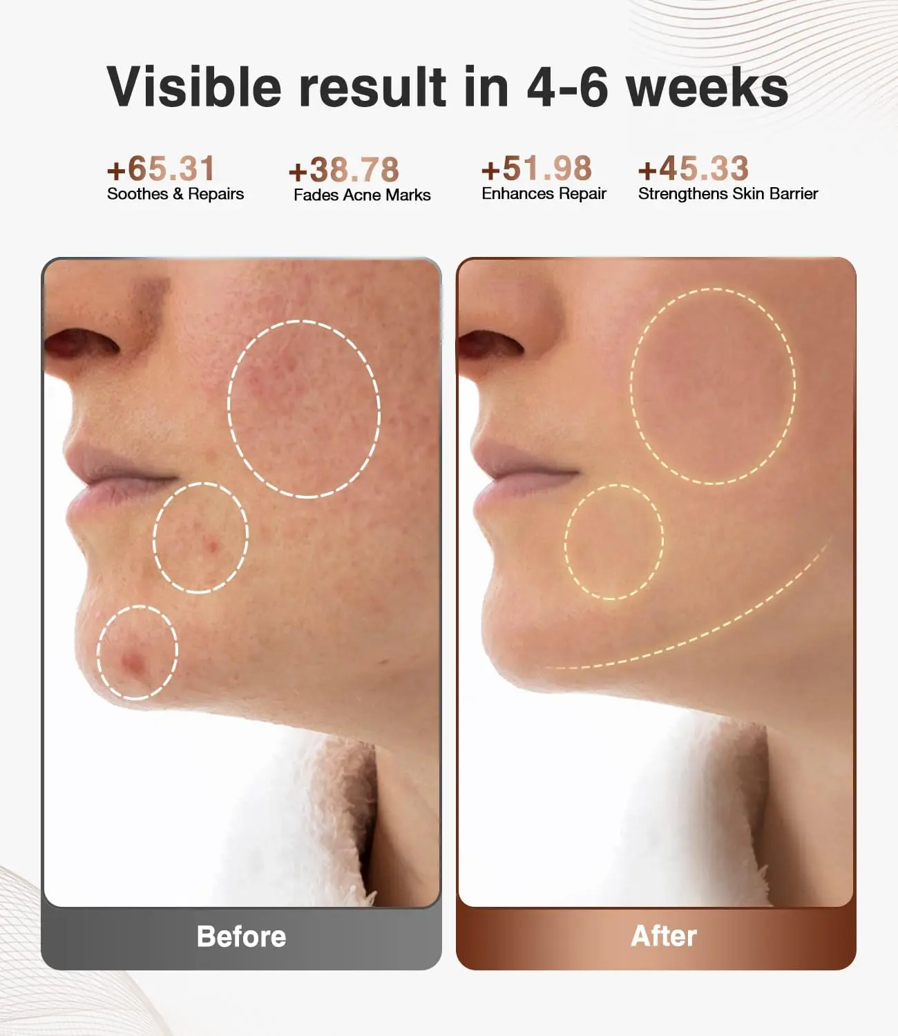 Professional LED Face Mask Red&Infrared Light Facial Mask for Beauty Skin Rejuvenation Acne Treatment Facial Therapy Device