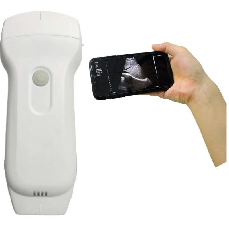 2026 Veterinary USB Wireless WIFI Portable Handheld  Lightest Portable Wireless&USB 3 in 1Color Doppler Ultrasound Scanner