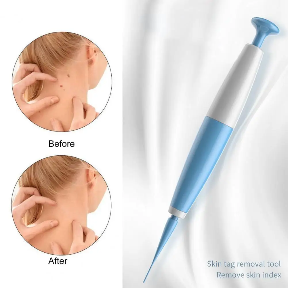 مجموعة أقلام متطورة لإزالة العلامات الجلدية للرجال والنساء ، سهلة الاستخدام ، مجموعة مزيل الثآليل ، آمنة ، فعالة ، صغيرة لسرعة