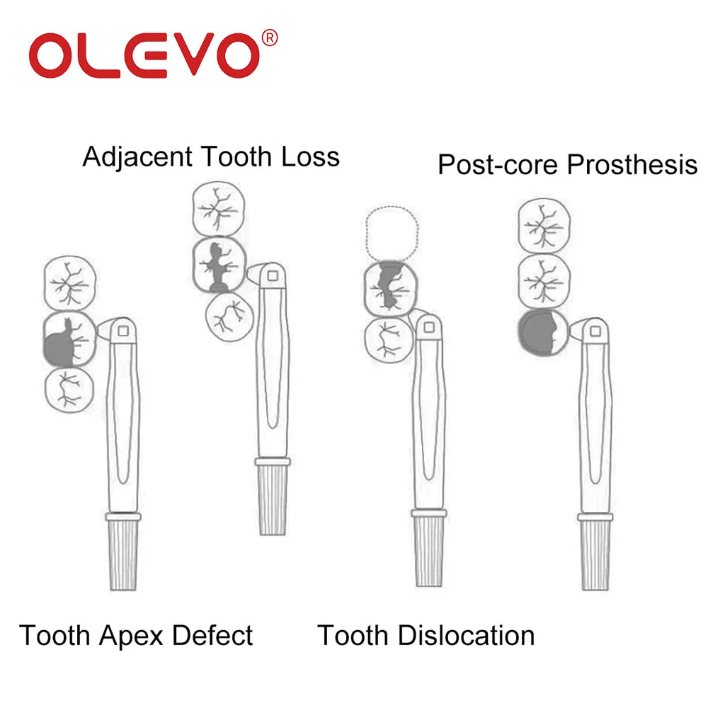 10 sztuk Dental regulowane Pro opaski matrycowe uchwyt na matryce jednorazowe matryce System zaciski kompozytowe narzędzia do przywracania