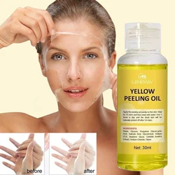 Yellow Peeling Oil For Dark Skin Bleaching Exfoliating For Face Lightening Body Peeling Dead Skin Removal Brighten Skin Tone 30M