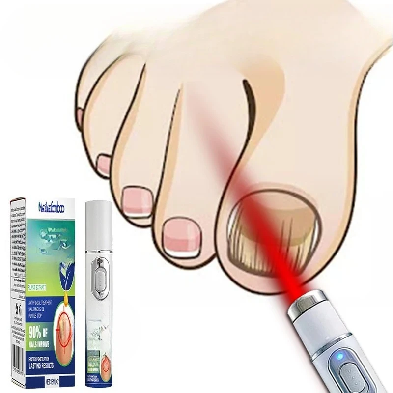 

Лазерная ручка грибка ногтей