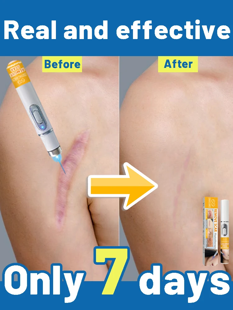 

Removes old and new scars on the face and body