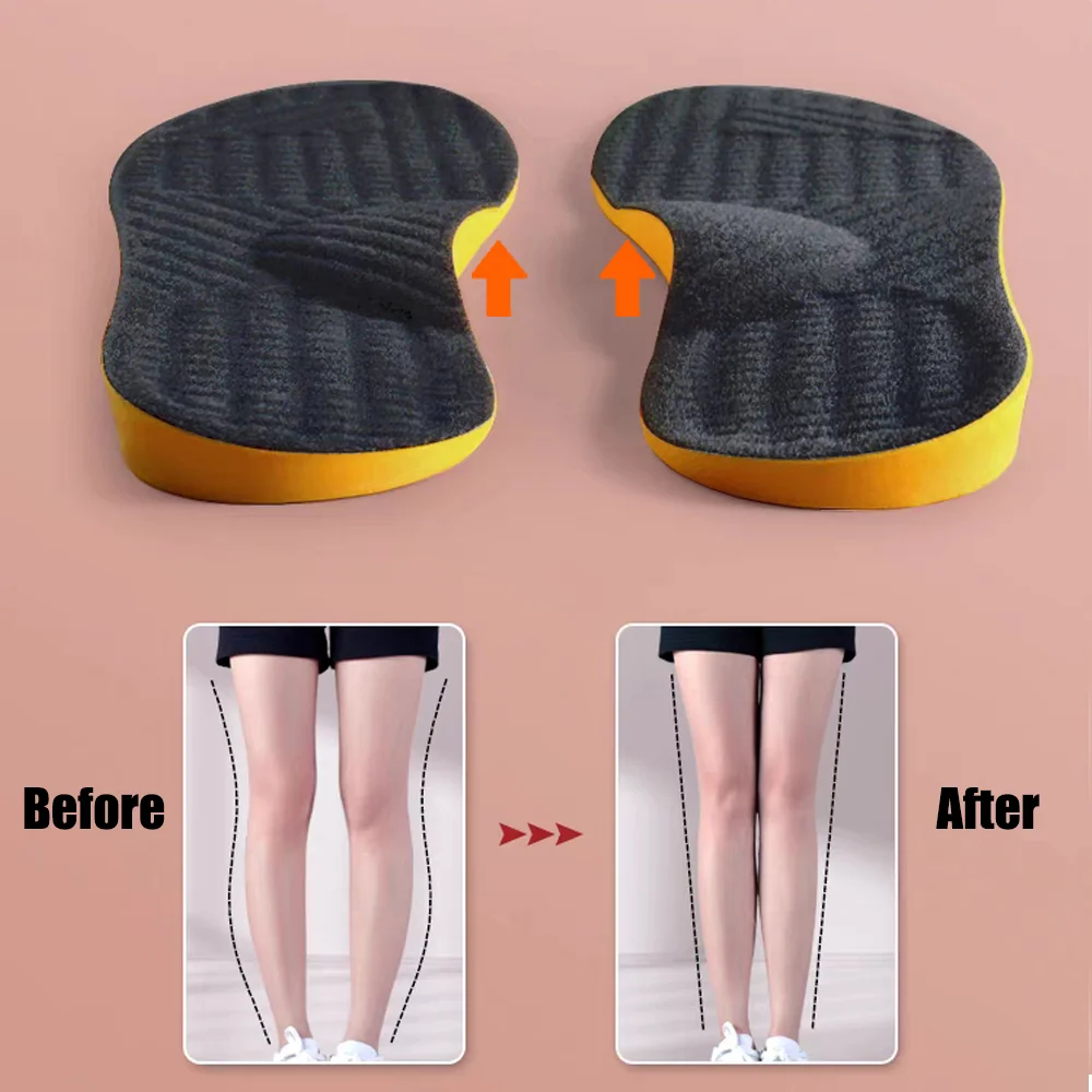 

PU Orthotic Insole Arch Support Flat Foot Orthopedic Insoles for Shoes Women Men X/O Type Legs Valgus Feet Correction Shoe Pads