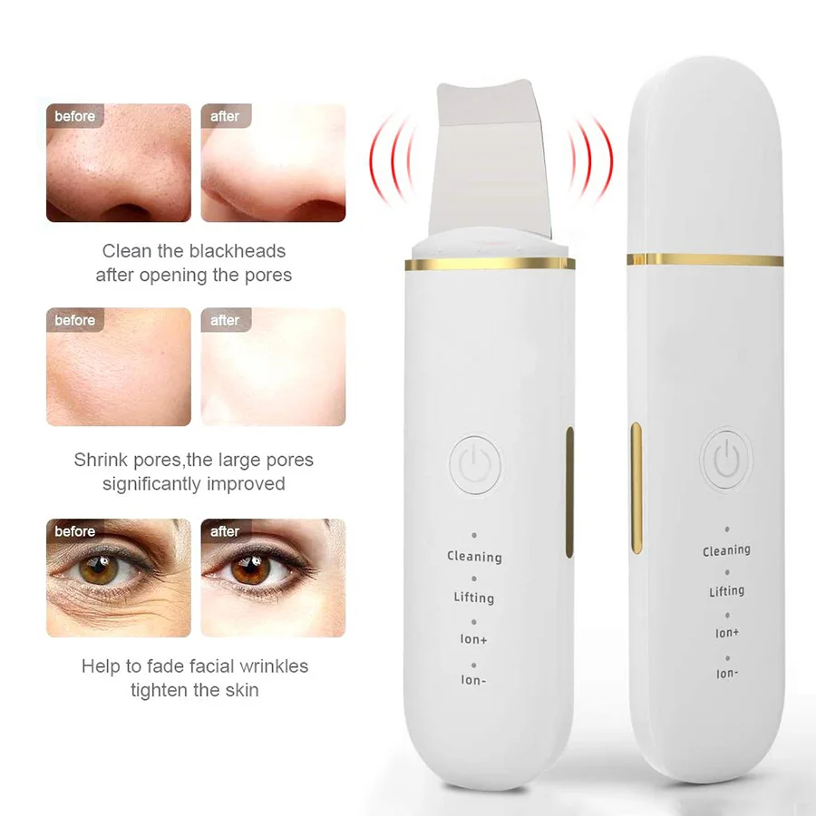 Ultrasonic facial cleanser - USB rechargeable, vibrating facial scraping device that can remove blackheads, lift and tighten,