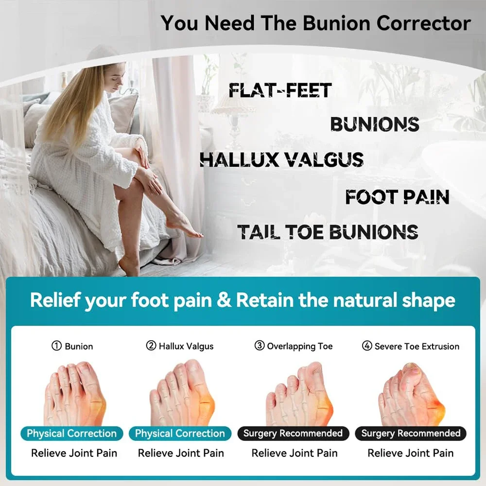 Corrector de juanete Hallux Valgus ajustable, separador de dedos, ortopédicos, ajustador de hueso, alisador de pulgar, herramientas de pedicura para el cuidado de los pies