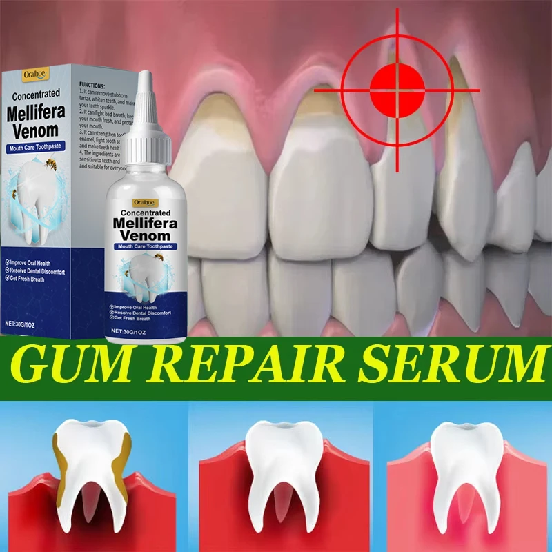 Pulizia dei denti Siero sbiancante Rimuovi placca Denti bianchi Gel Denti Macchie di fumo giallo Dentifricio Alito fresco Cura dell'igiene orale