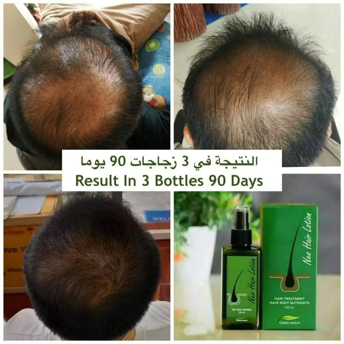 1Pcs Neo Hair Lotion 120ml Hair Treatment Hair Root Nutrients Anti-Loss Beard Regrowth Original Thailand