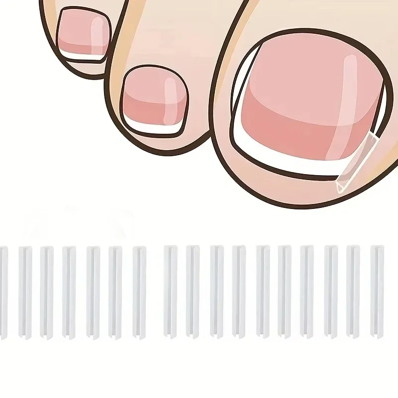 Ingrown Toenail Correction Tool Ingrown Toe Nail Treatment Elastic Patch Sticker Straightening Clip Brace Pedicure Tool