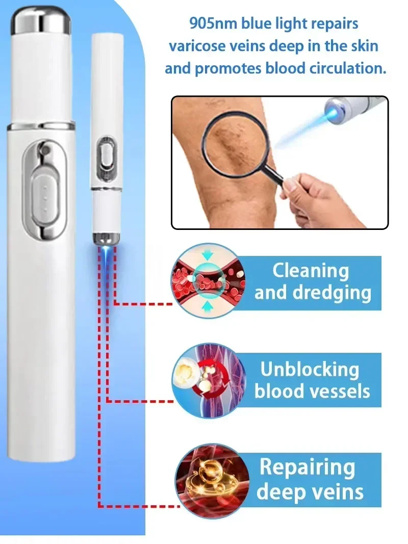 قلم ليزر أزرق مطور حديثًا، يحل الدوالي، مما يسمح لك أن تتمتع بأرجل صحية جديدة 2020 #5