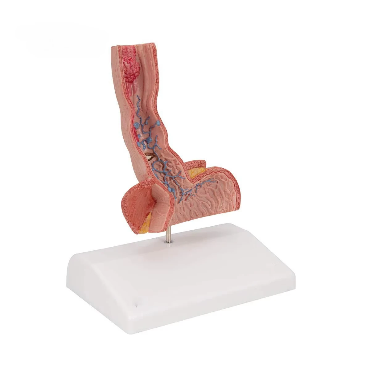 Medical Science Esophageal Diseases Principle Nursing Anatomy Model