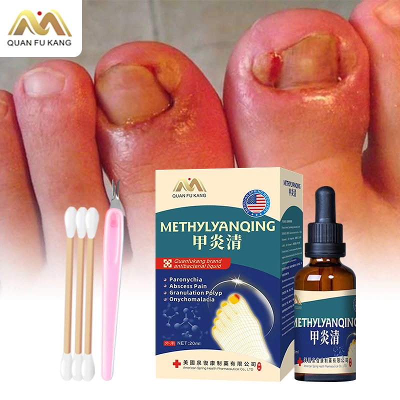 

Paronychia Treatment Tools Nail Ingrown Correction Onychomycosis Toenail Fungal Care Liquid Nail Fungus Cleaner American Formula