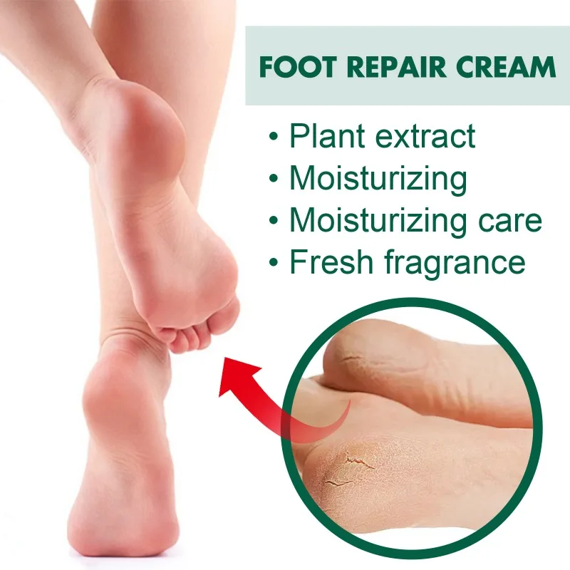 Fuß reparatur creme verhindern rissige trockene Anti-Juckreiz-Peeling-Fersen rissige Peeling feuchtigkeit spendende Fußpflege entfernen Kallus