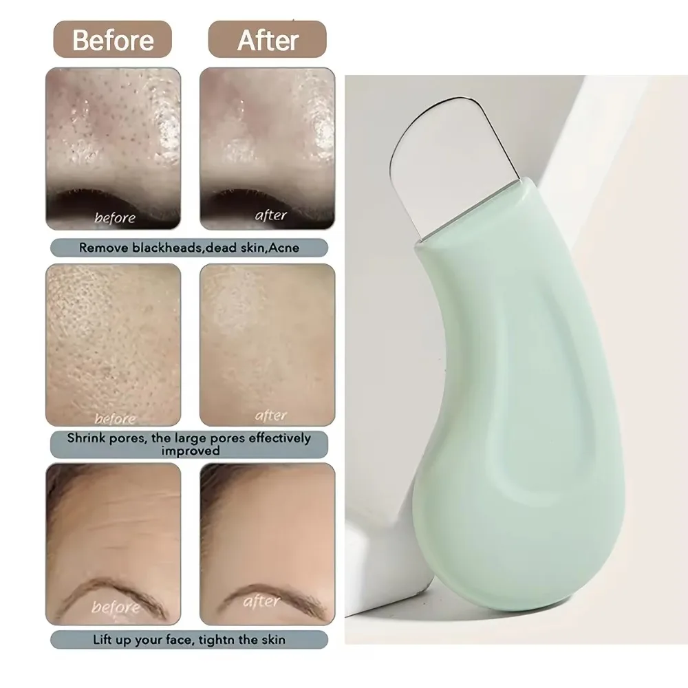 Óleo de limpeza ferramenta de remoção de cravo nasal facial mini ferramenta de cuidados de beleza poros limpeza acne remoção lâminas uso com creme de lama