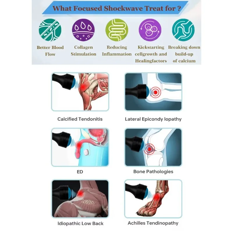 FSWT Shockwave Machine Vet Focales Focused Shock Wave Therapy Machine Plantar Fasciitis Erectile Dysfunction Treatment - view 3