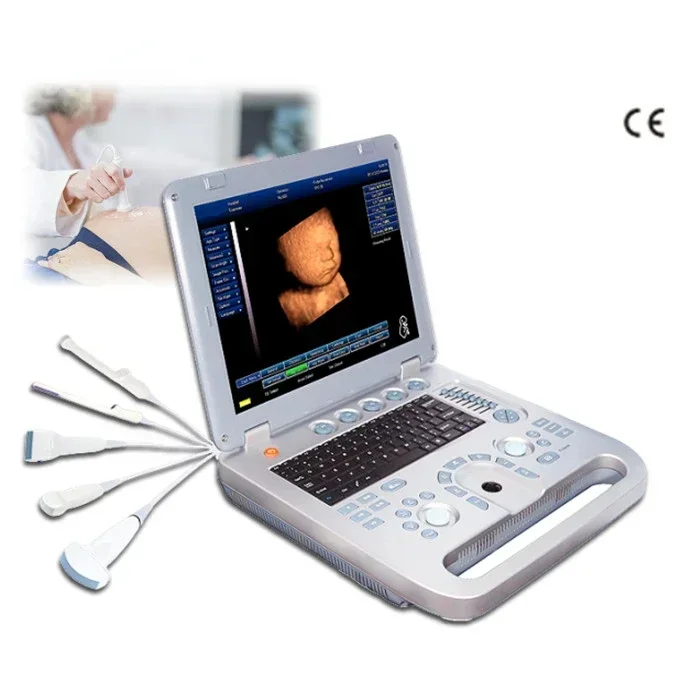 

SUN-800D portable B/W USG laptop ultrasound machine price ultrasound scanner from Sunbright