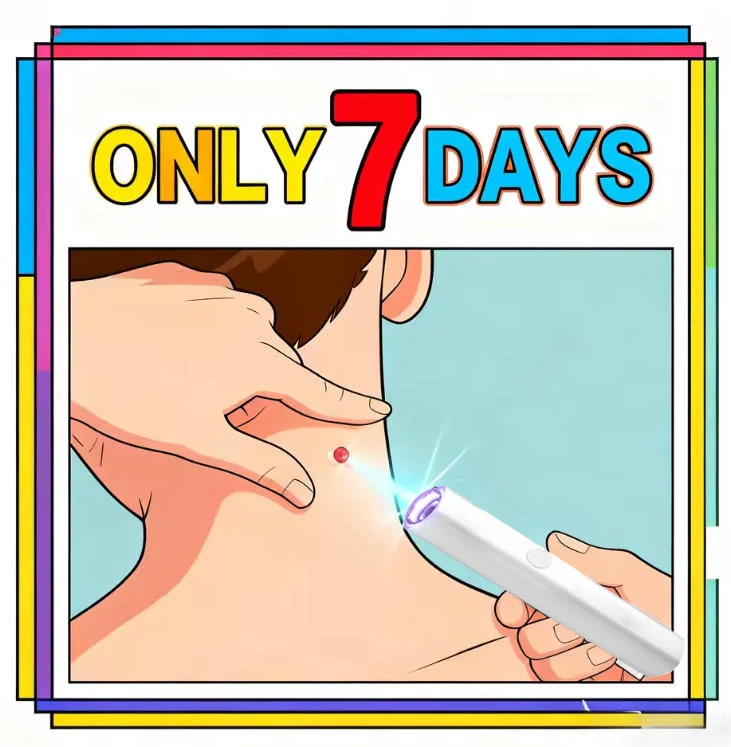 

2nd ᵍᵉⁿᵉʳᵃᵗⁱᵒⁿ ᵘᵖᵍʳᵃᵈᵉᵈ wᵃʳᵗ ⸴ ᑫᵘⁱᶜᵏˡʸ， ʳᵉpᵃⁱʳ wᵃʳᵗˢ ʳᵒoᵗ