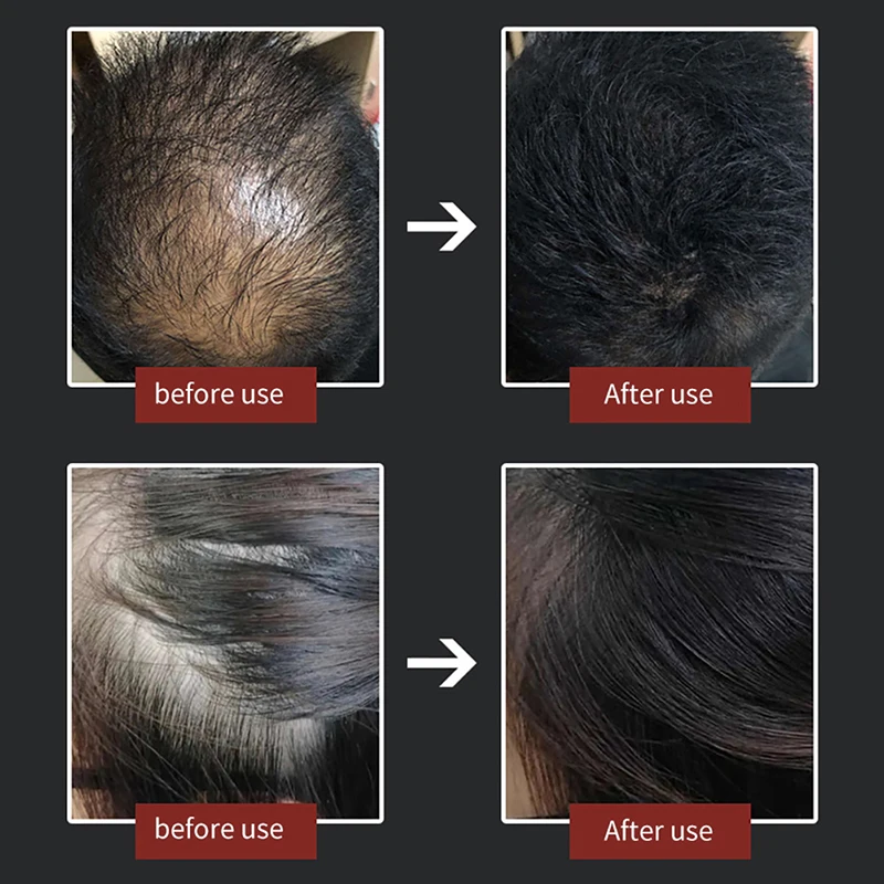 Hair Fibers Powder Special Comb Hair Loss Building Fibers Hair Line Optimizer Hair Thickening Fibers