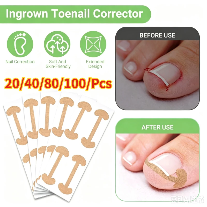 20-100pcs Ingrown Toenail Correction Strips Lasting Adhesion Waterproof Nail Correction Stickers Elasticity Toe Care Pedicure