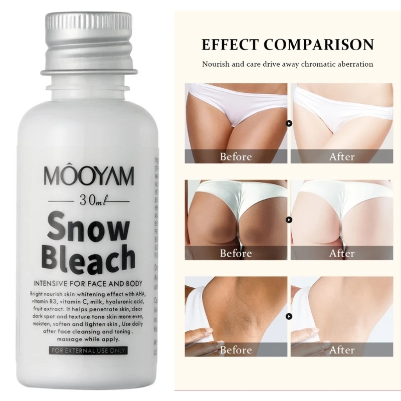 كريم تبييض البشرة السوداء لتبييض الجسم تحت الإبط 30 جرام