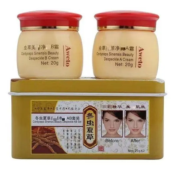 Aweto Whitening Anti-Acne Day Night Cream Set Dark Spots Freckle Remover Skin Lightening Skin Care