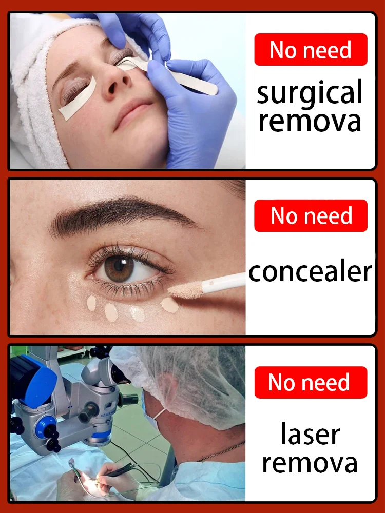 Instant Eye Bag Remover Gel-Cream Erase Bags Under Eyes | Dark Circle Corrector | 7 Days Visible