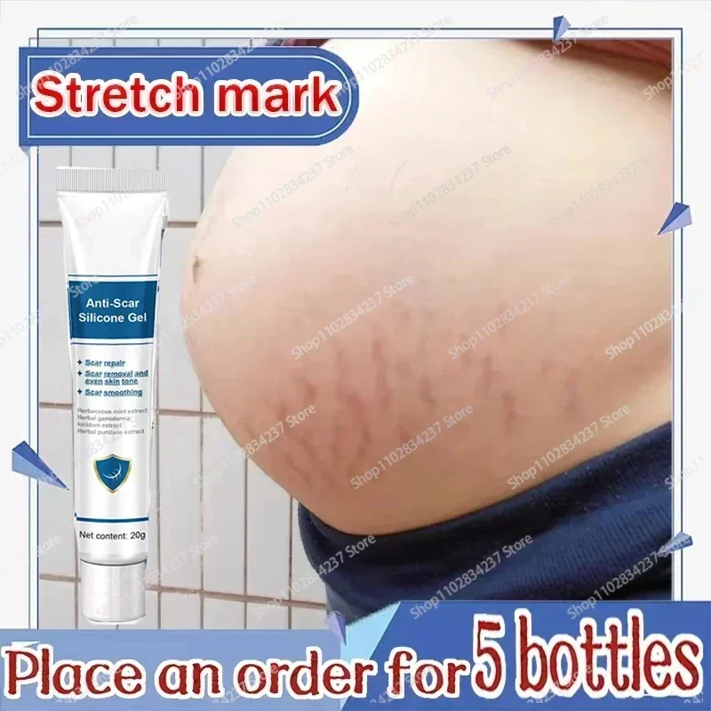 

Pregnancy Stretch Marks Removal Eliminate Red White Old Stretch Marks