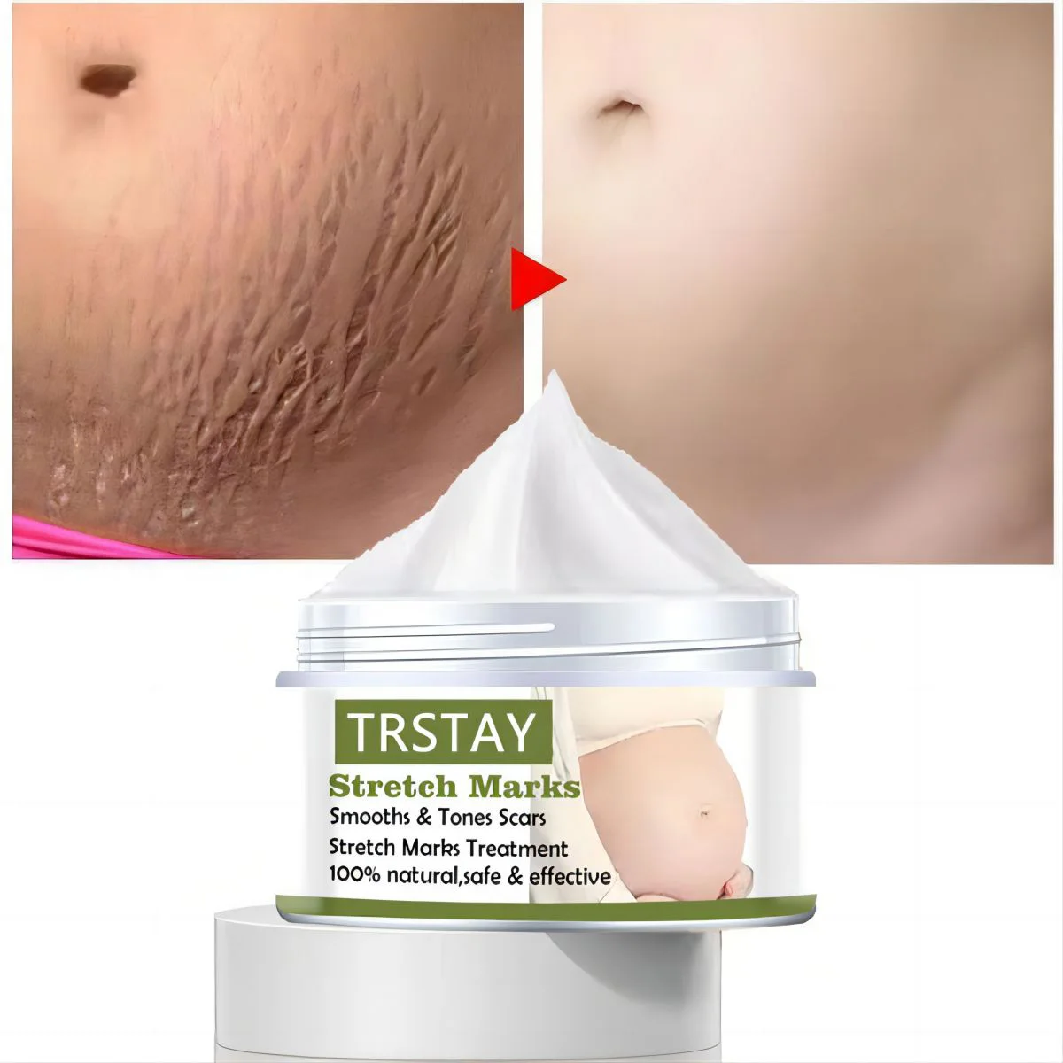 Pregnant Women's Belly Line Cream For Preventing Postpartum Pregnancy Lines Repair Cream