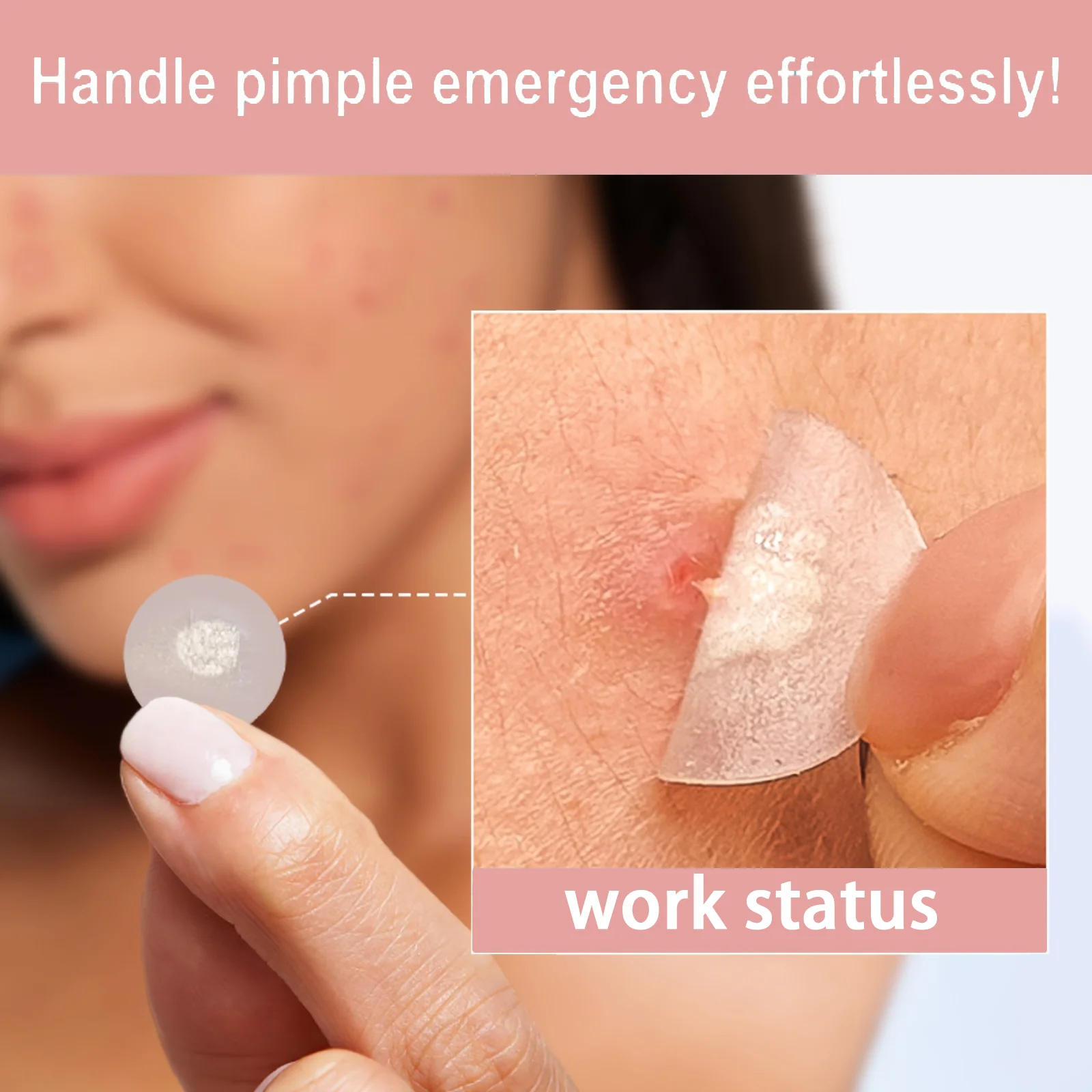 180/360/540pcs Hydrocolloid Acne Patches — Invisible, High-Quality Patches Infused with Tea Tree Oil Suitable for All Skin Types image 6