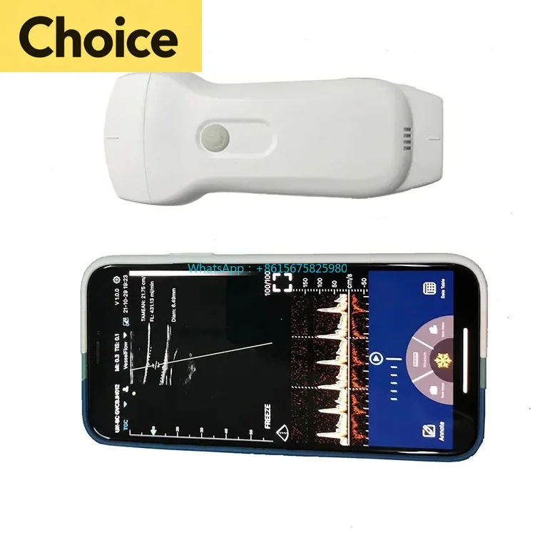 C10RL Wireless Vein Viewer, Handheld U ltrasound Infrared Vein Detector