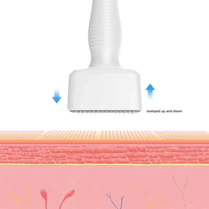 Derma Stempel Roller 140A Einstellbare Micro Derma Stempel Für Haar Nachwachsen Gesicht Hautpflege Schönheit Gerät – Detail 9