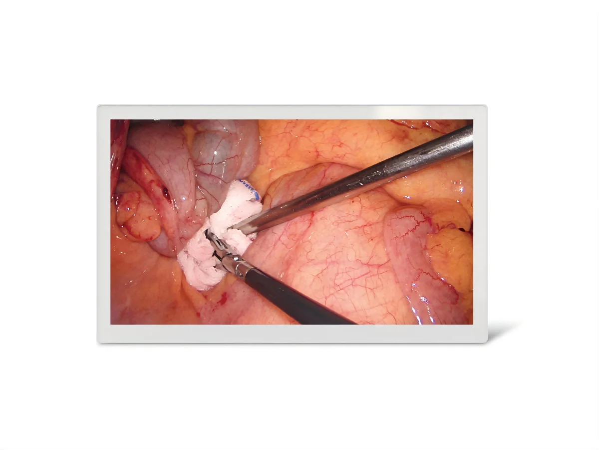 2026 New 4K Ultra HD Endoscopic Laparoscopic System Dedicated Platform For Minimally Invasive Use​